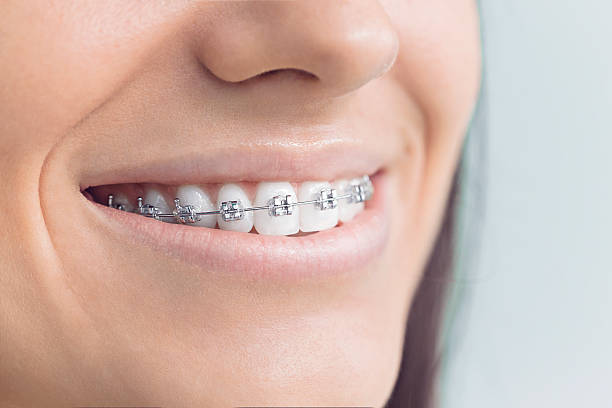 Best Veneers and Lumineers  in Southern Shops, SC
